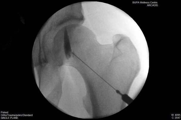 10714457_10155174938220635_1052429405880051043_o